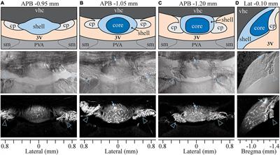 Anatomical Organization of the Rat Subfornical Organ